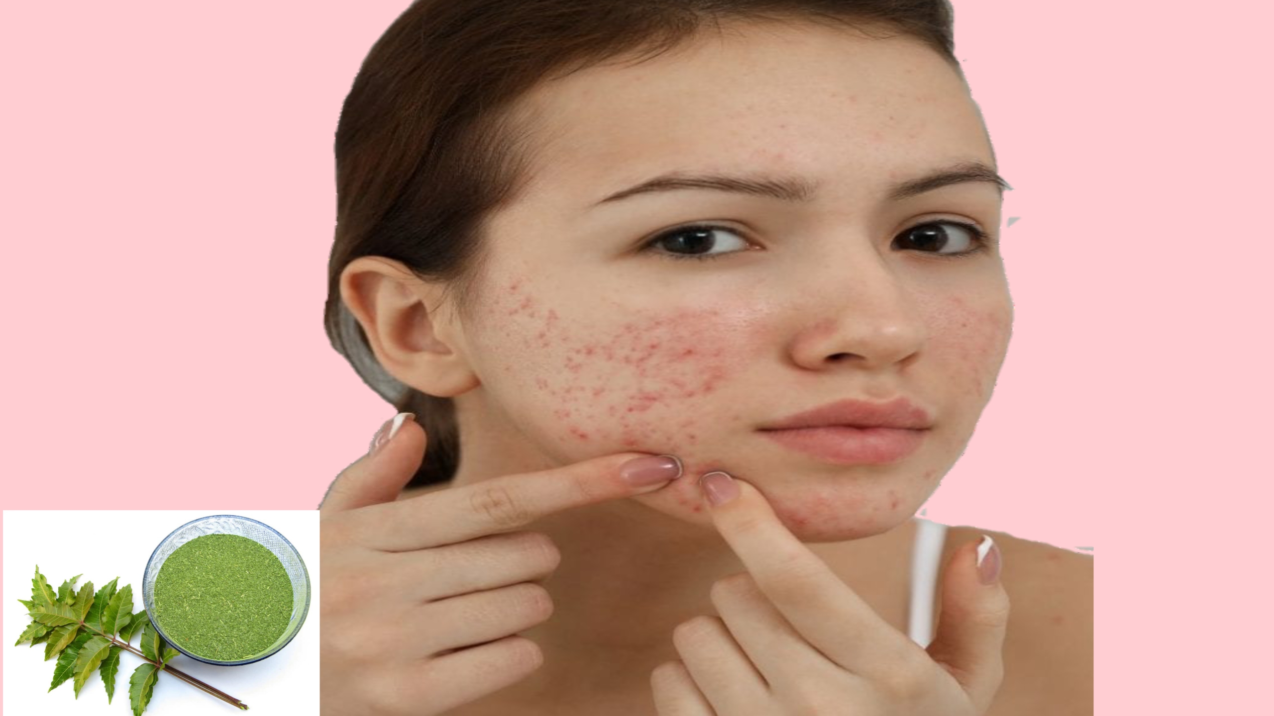 चेहरे से पिम्पल को गायब कैसे करें